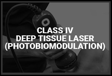 Class IV Deep Tissue Laser (Photobiomodulation) Near Lutz