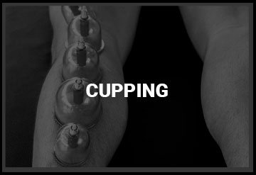 Cupping Therapy Near Land O'Lakes